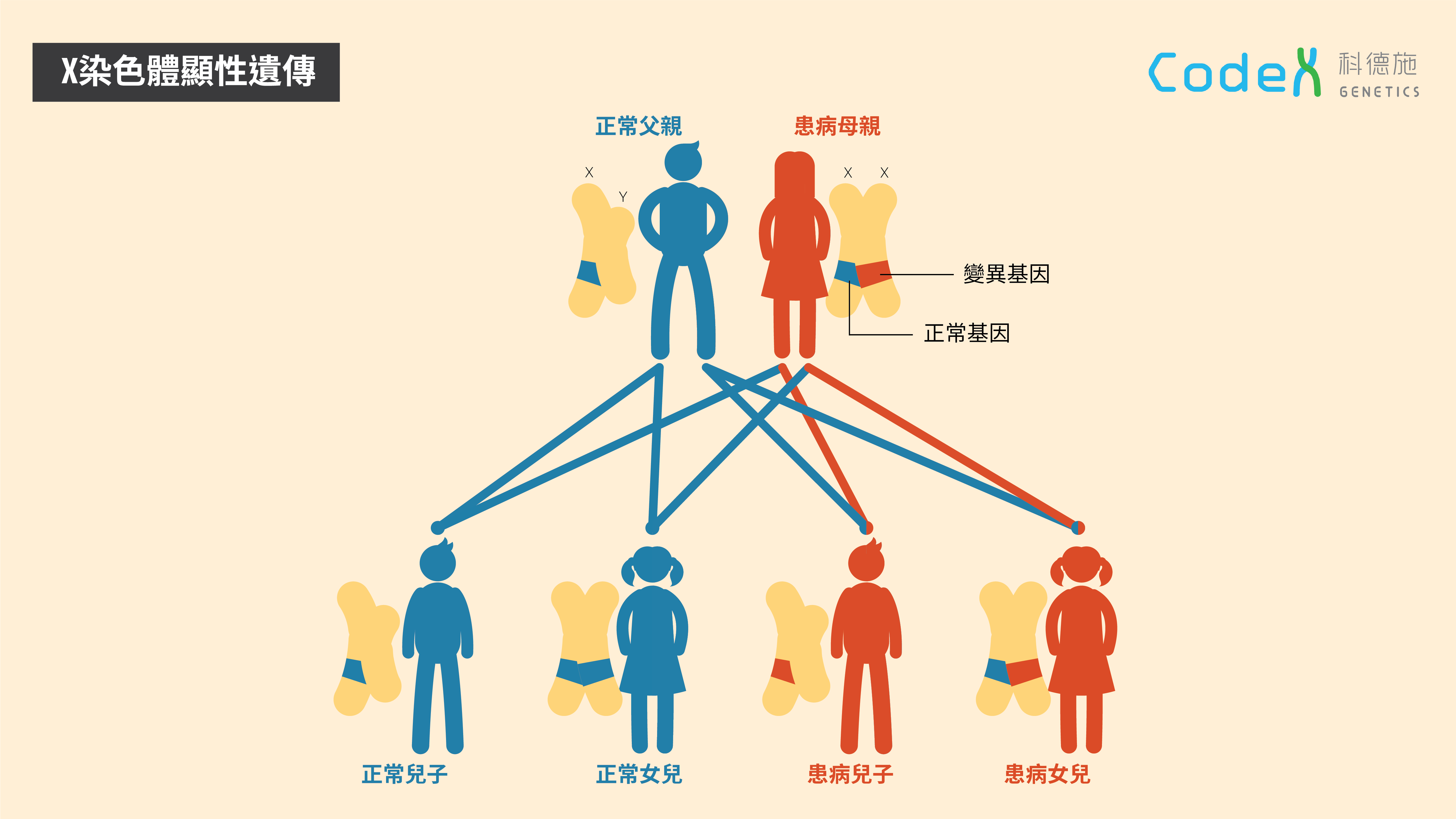 X染色體顯性遺傳