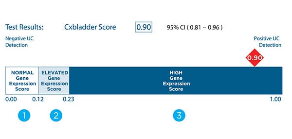 cxbladder-detect-test-results.jpg